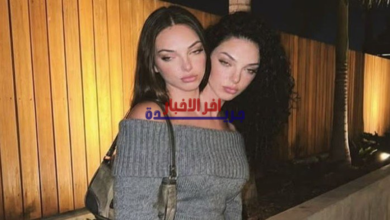 حقيقة التؤام الملتصق فاليريا وكاميلا